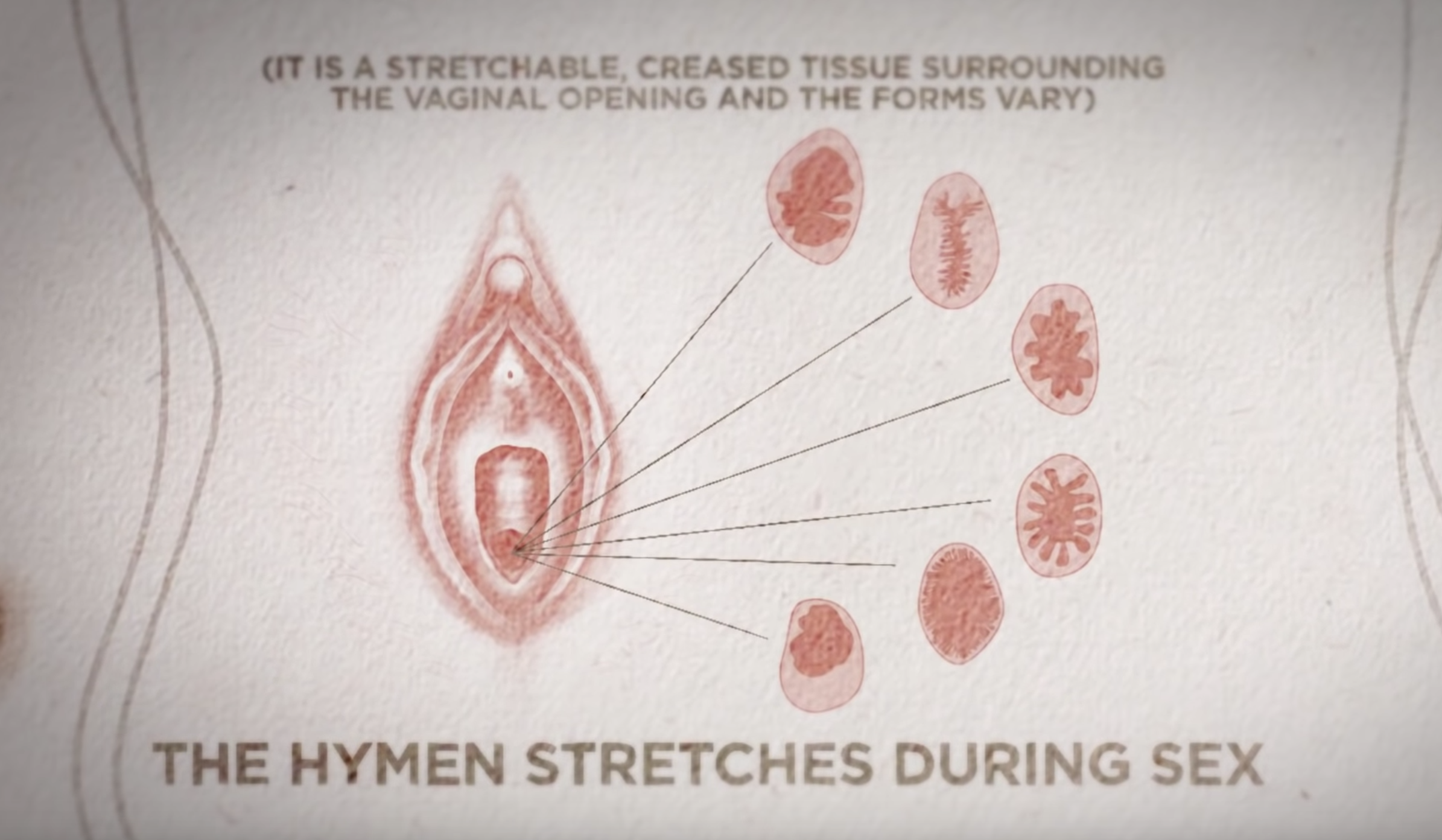 Here's A Hymen Explainer That Is Safe For Work