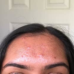 Reviewer photo of forehead before using oil blotting sheets