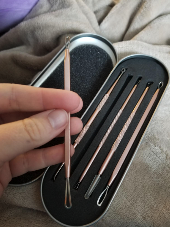 case of blackhead tools that look like metal sticks with differently shaped loops on each end. A reviewer&#x27;s hand is holding one from the case.
