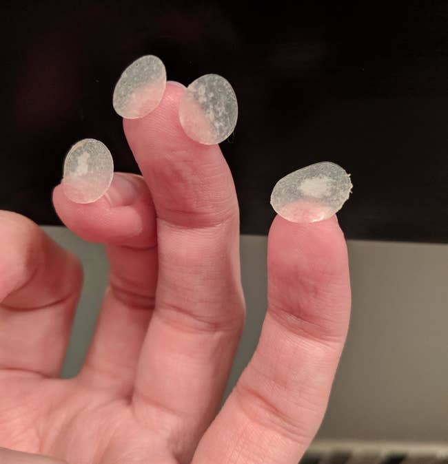 Reviewer photo of used pimple patches