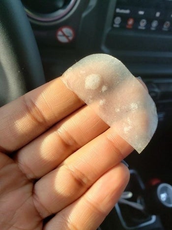 photo of pimple gunk from a reviewer's pimple patch