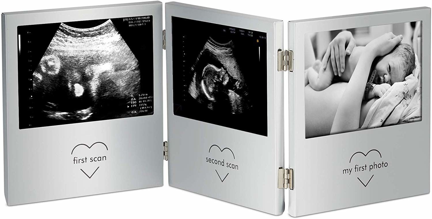 The photo frame has three dedicated slots for the baby&#x27;s first scan, second scan, and first photo.