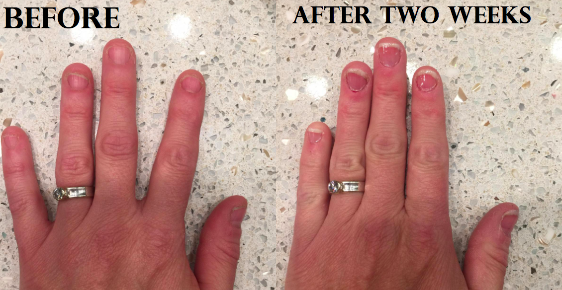 a reviewer&#x27;s nails before and after using the product