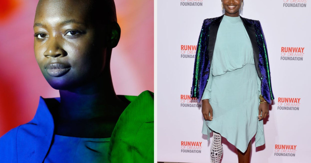 Meyrignac mamma prosthesis 03 image