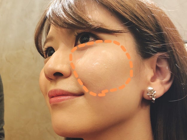 これはマジで革命 ファンデを超える最新コスメでシミがほぼ完璧に隠れた Buzzfeed Japan Goo ニュース