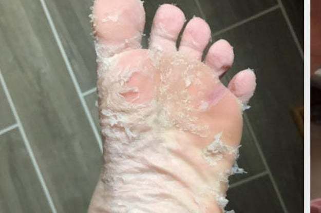 This Exfoliating Foot Peel Is The