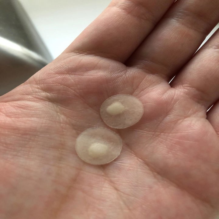 hand holding two patches with white gunk absorbed from acne