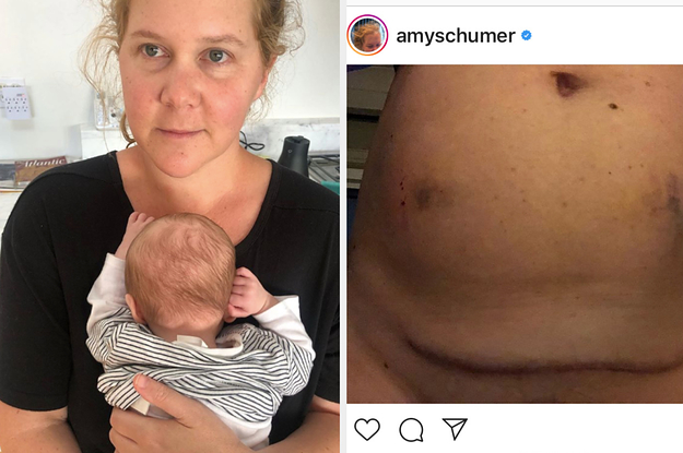 I'm an image I'm an image