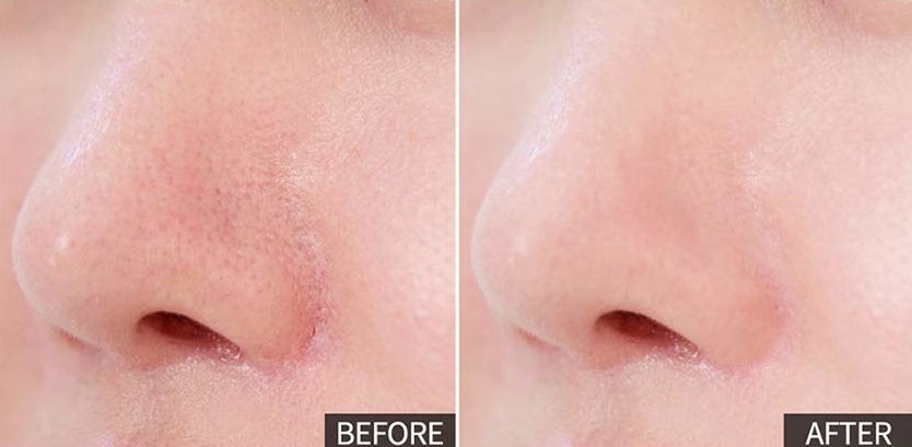 pic on left shows a person&#x27;s nose with visible pores, lines, redness, and pic on right shows the person with makeup with smoother looking skin