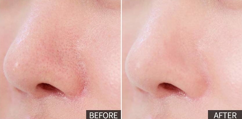 pic on left shows a person's nose with visible pores, lines, redness, and pic on right shows the person with makeup with smoother looking skin