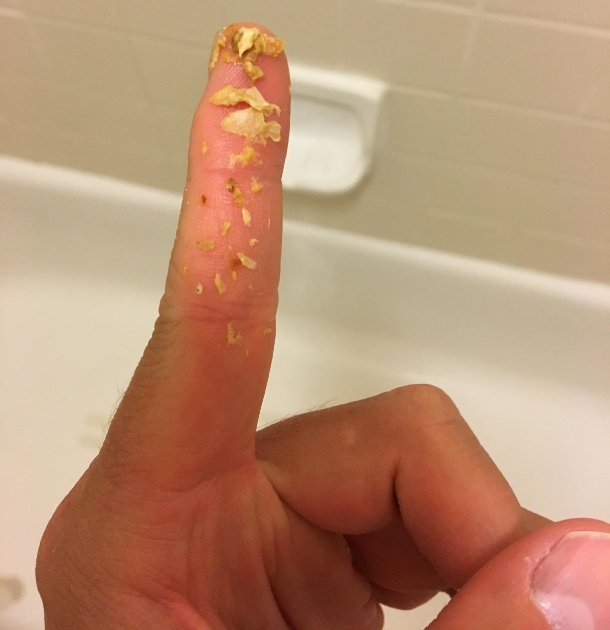 Reviewer photo of their finger covered in chunks of ear wax
