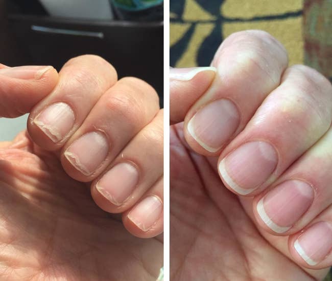 A reviewer with brittle, chipped nails and dry cuticles on the left, and the same hand with healthy-looking nails and cuticle on the right 