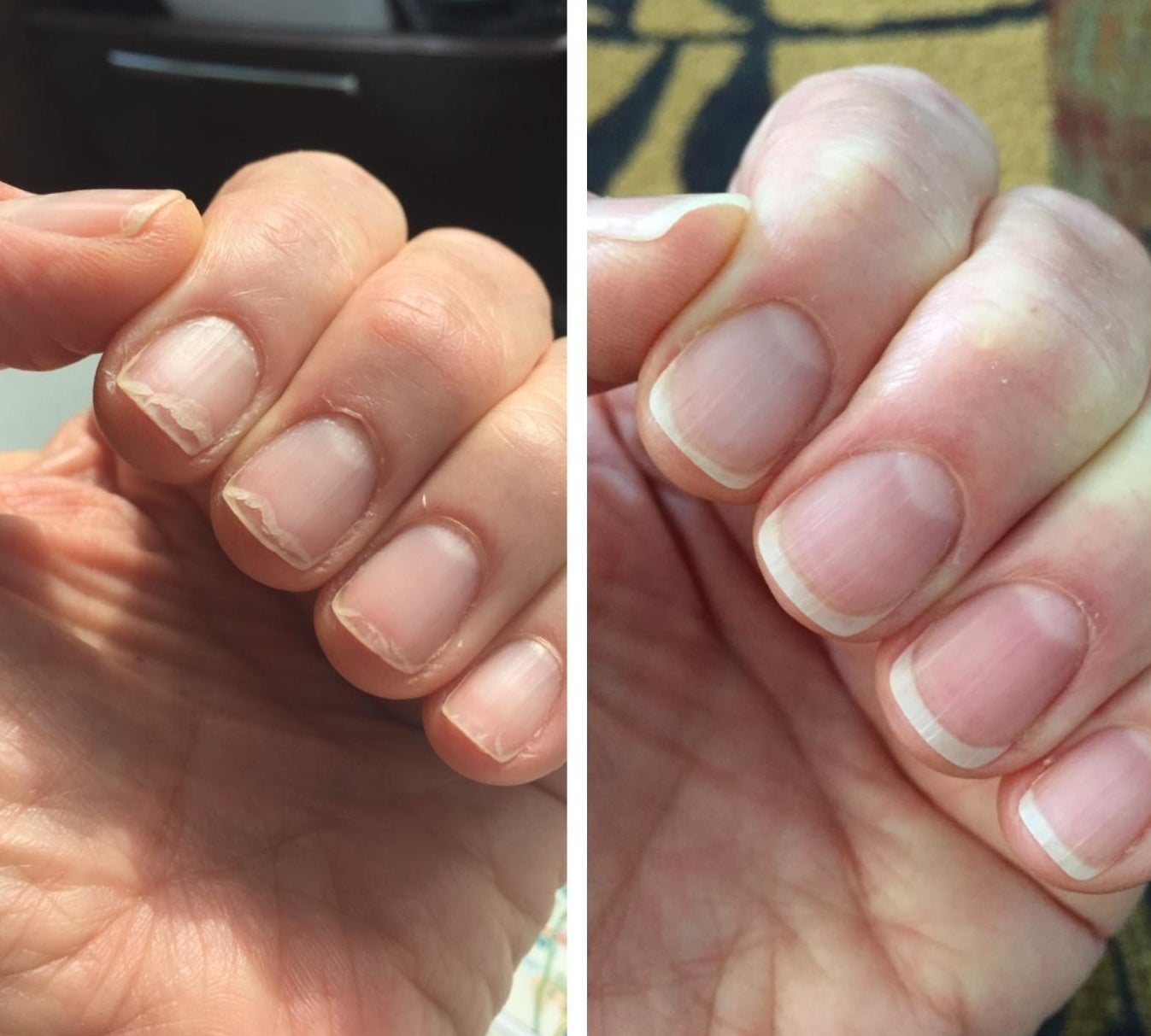 A before-and-after of a reviewer&#x27;s peeling, split nails compared to their now even and non-peeling nails 