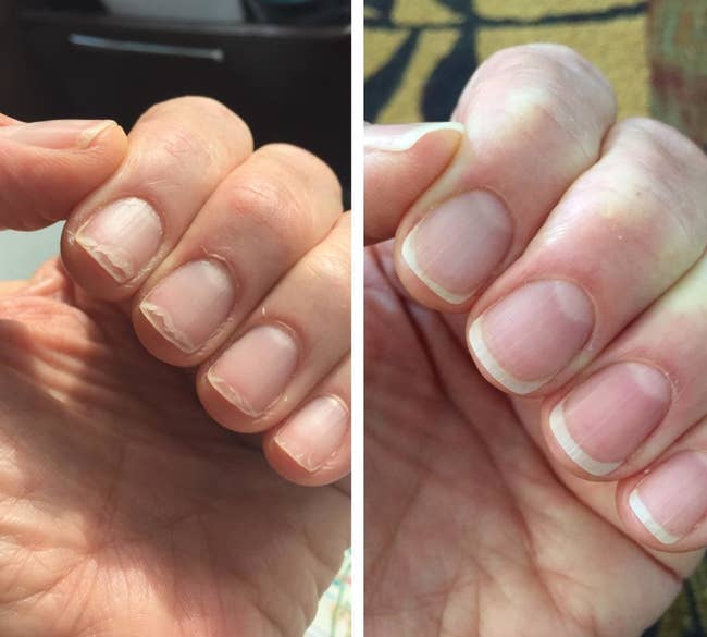 A split reviewer image showing a hand with brittle, chipped nails and dry cuticles on the left, and the same hand with healthy-looking nails and cuticle on the right 