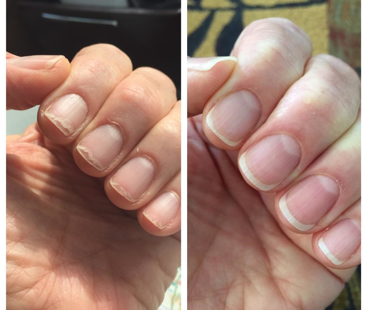 A split reviewer image showing a hand with brittle, chipped nails and dry cuticles on the left, and the same hand with healthy-looking nails and cuticle on the right 