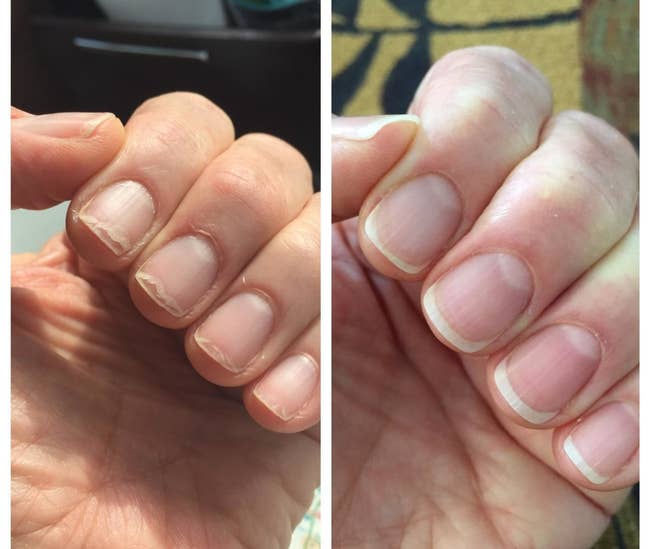 A split reviewer image showing a hand with brittle, chipped nails and dry cuticles on the left, and the same hand with healthy-looking nails and cuticle on the right 