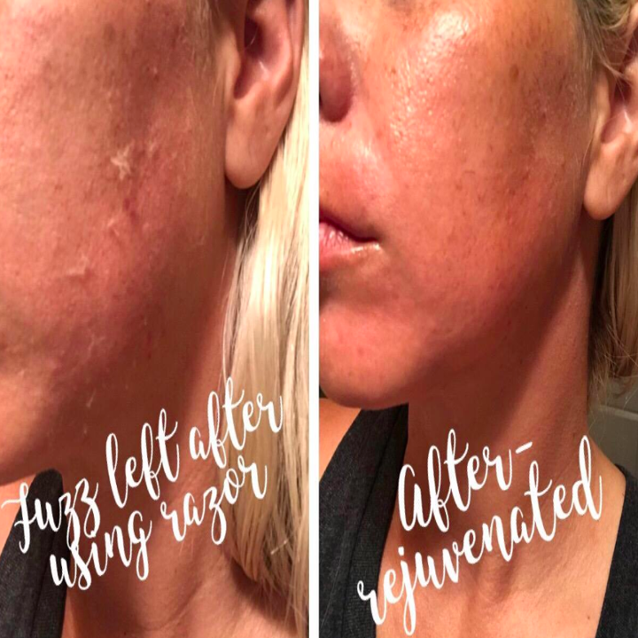 A customer review photo showing their skin before and after using the razor