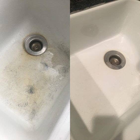 Split before-and-after photo of a white enamel sink showing silver stains and discoloration on the left side and the stains being gone on the right side. 
