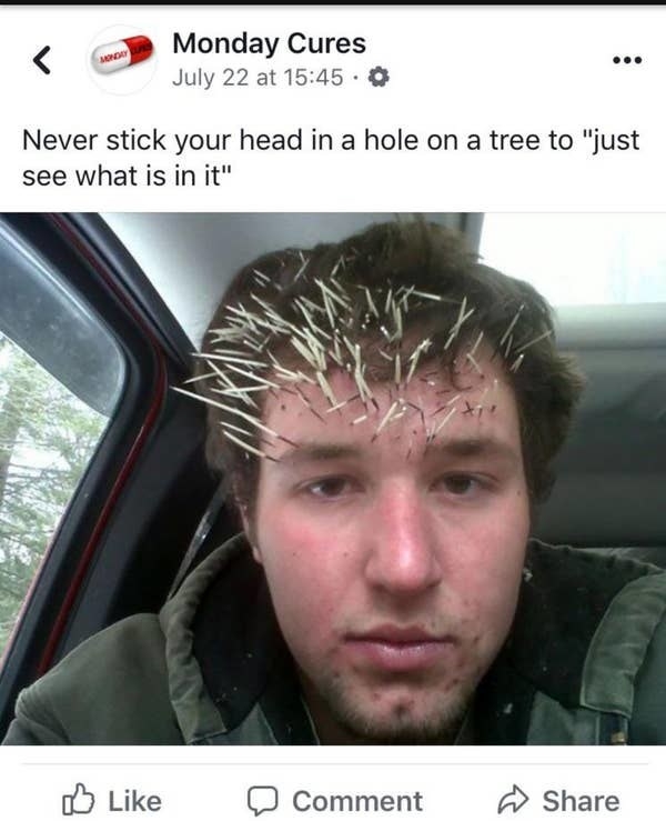 person who got spiked by a porcupine