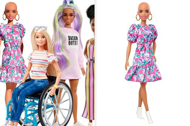 Mattel Has Introduced Barbie Dolls With Vitiligo And Alopecia, And They're Absolutely Amazing