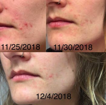 A series of customer review photos showing their skin before and after using the moisturizer