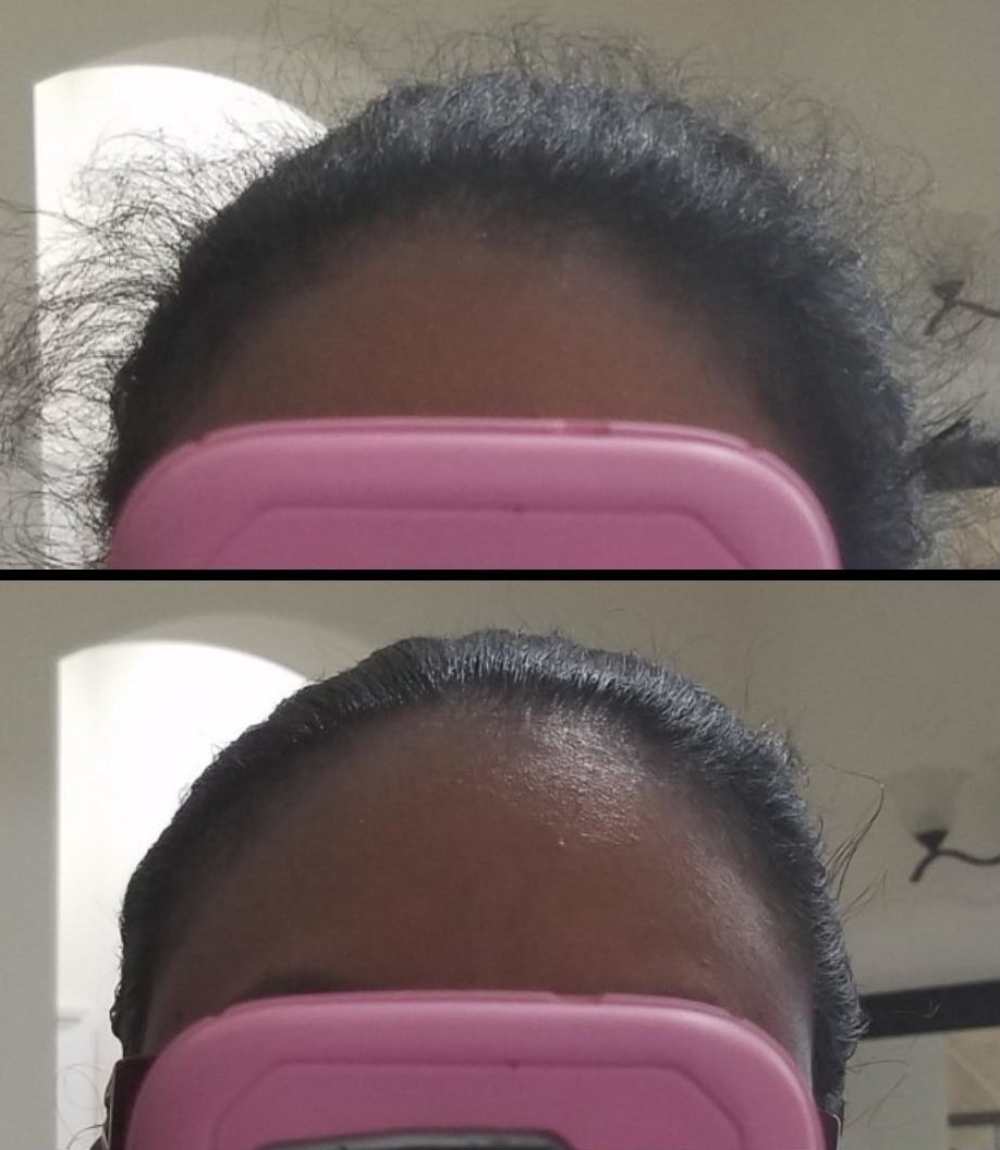 The top of a person&#x27;s head before and after using the hair-finishing stick. Before using the stick, there is a lot of frizz. After using the stick, the hair is slicked back.