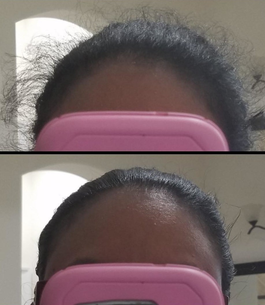 The top of a person&#x27;s head before and after using the hair-finishing stick. Before using the stick, there is a lot of frizz. After using the stick, the hair is slicked back.