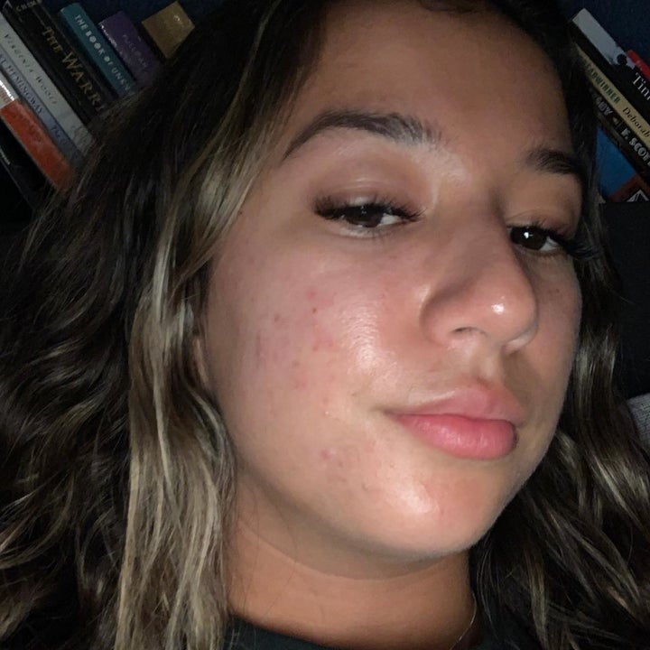 The same face with less breakouts. 