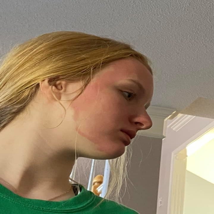 Download Yes To Has Pulled Grapefruit Face Masks After Women Complained Of Redness And Burning PSD Mockup Templates