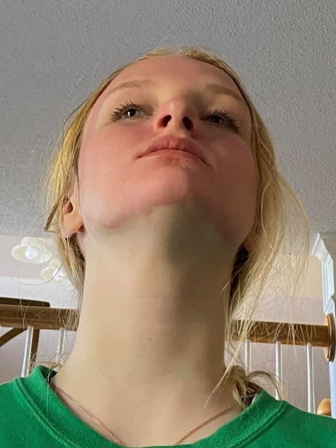 Download Yes To Has Pulled Grapefruit Face Masks After Women Complained Of Redness And Burning PSD Mockup Templates