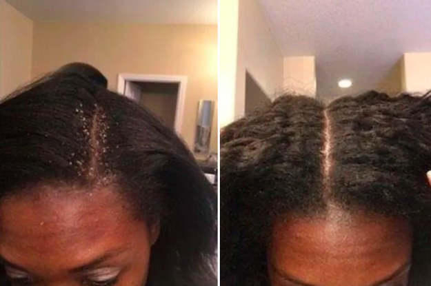 If Your Natural Hair Is Too Damn Dry Stop What You Re Doing And Read These 12 Expert Tips