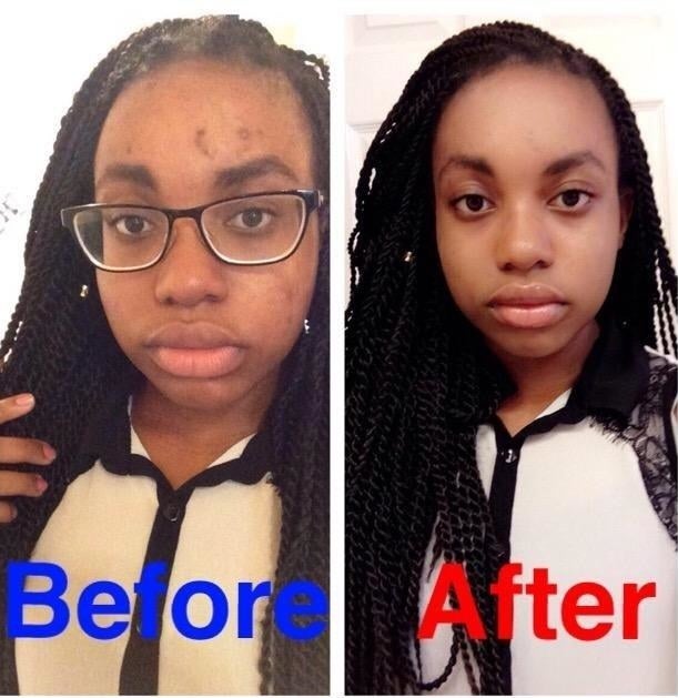 Before: a reviewer with slightly uneven tones in their skin; after: the reviewer's skin looking very even-toned