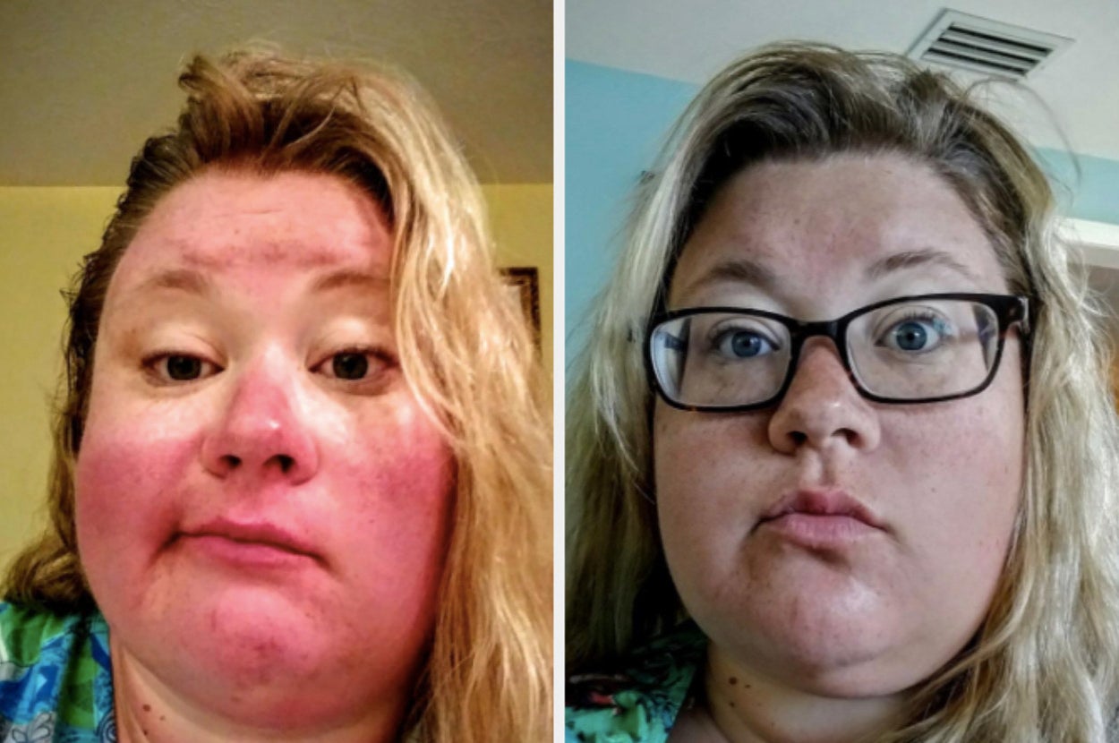 31 Personal Care Products That According To Reviewers Begin Delivering Results "Immediately"