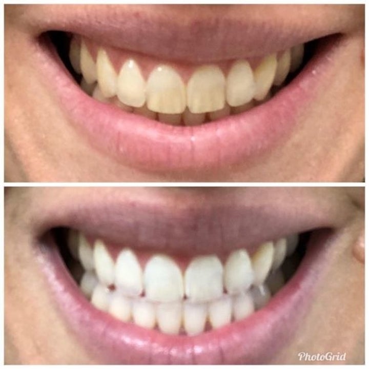 Reviewer photo showing before-and-after results