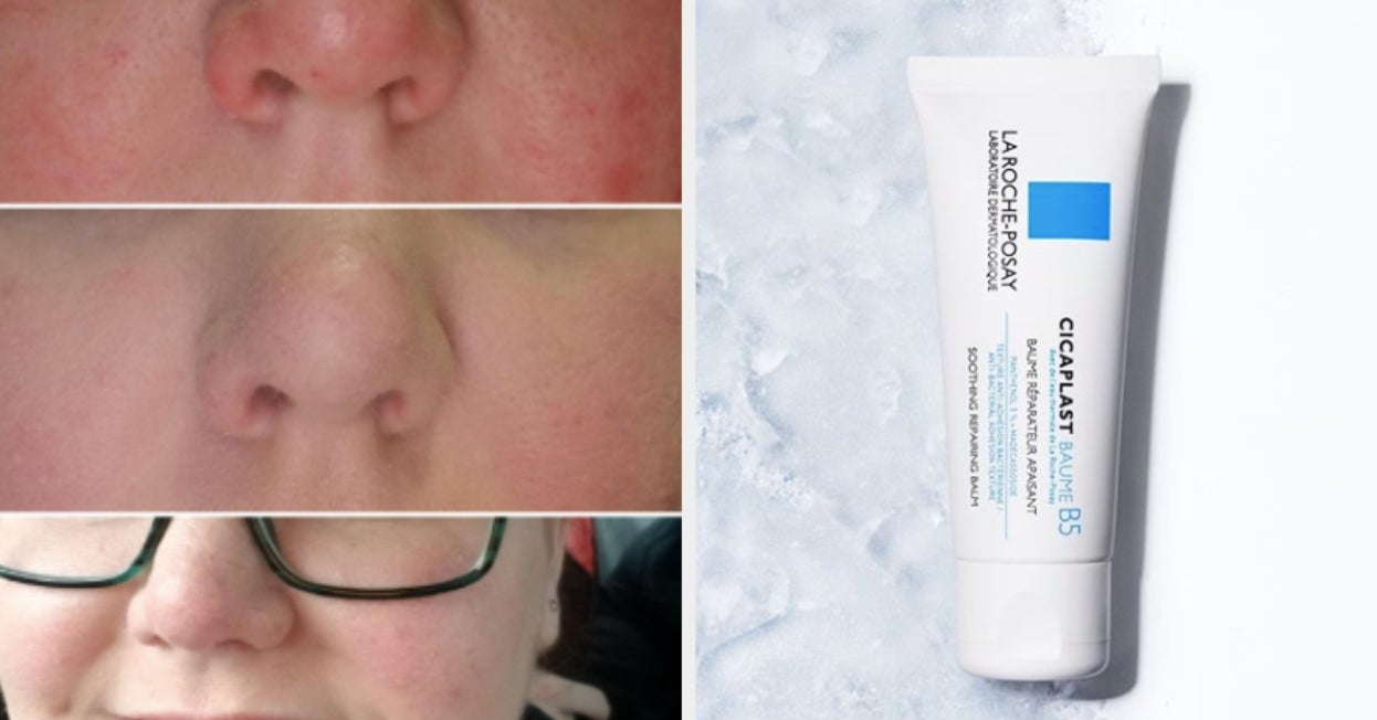  COSRX Pure Fit Cica Intensive Cream 1.7oz - Dry Sensitive Skin,  Acne-Prone, Redness Relief, Korean Skincare : Beauty & Personal Care