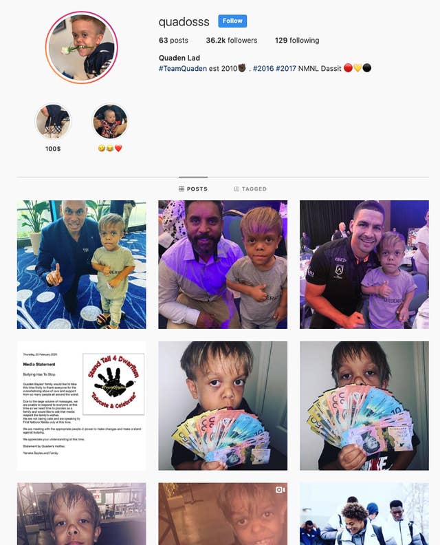 Conspiracy Theory About Quaden Bayles Bullied Boy With Dwarfism Explained