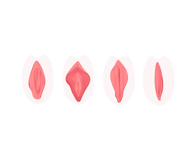 diferent vagina shapes