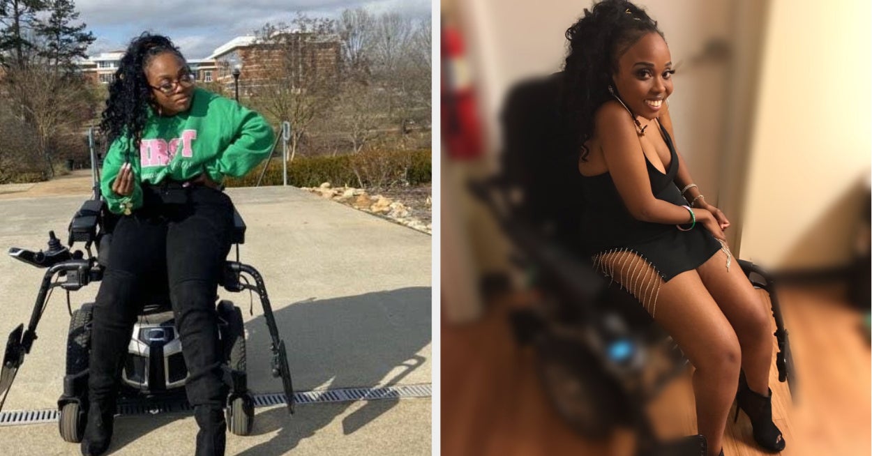 Rarest Disability A Woman With A Rare Disability Is Getting Overwhelmingly Positive ...