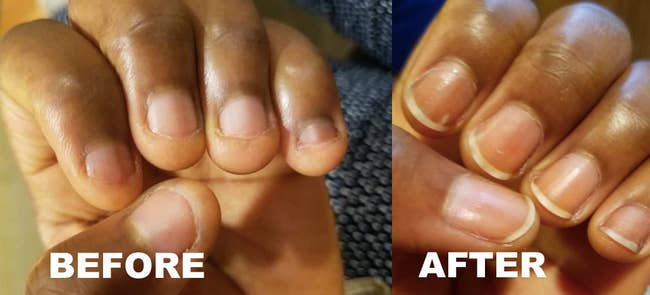 a before and after photo set displaying a reviewer's nail growth after using the clear polish