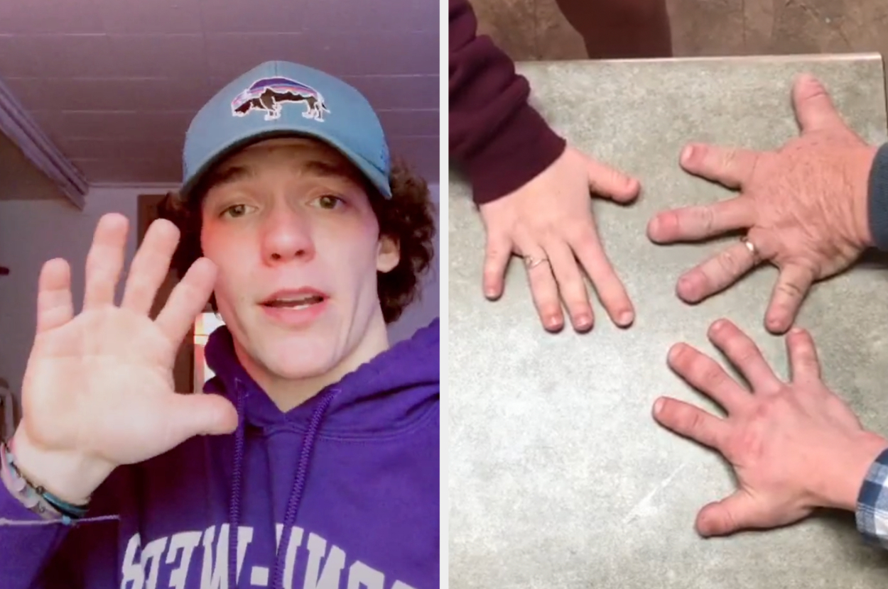 This TikTok Family With Brachydactyly, AKA Tiny Hands, Is A Breath