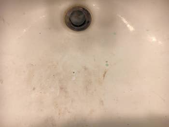 A customer review before photo of their white porcelain sink with stains on it