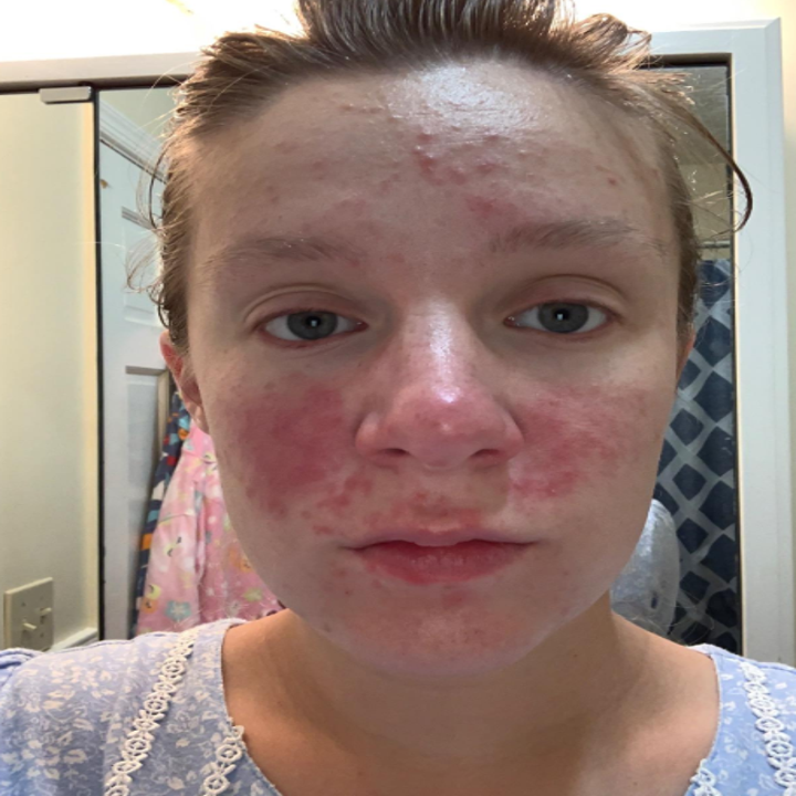 8 Face Masks With BeforeAndAfter Photos That Might Make You A Believer