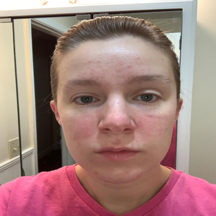 8 Face Masks With BeforeAndAfter Photos That Might Make You A Believer