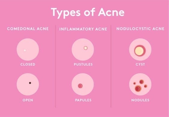 Chart of different kinds of pimples