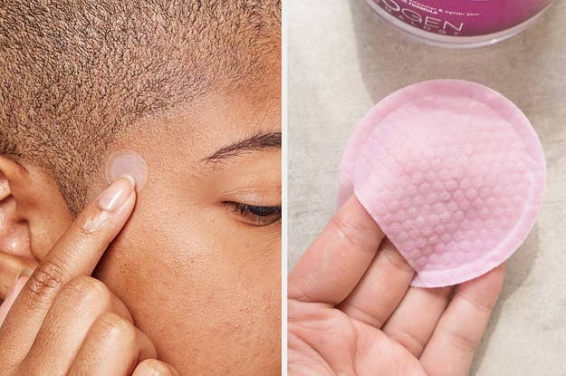 How To Get Rid Of Big Zits Fast لم يسبق له مثيل الصور Tier3 Xyz