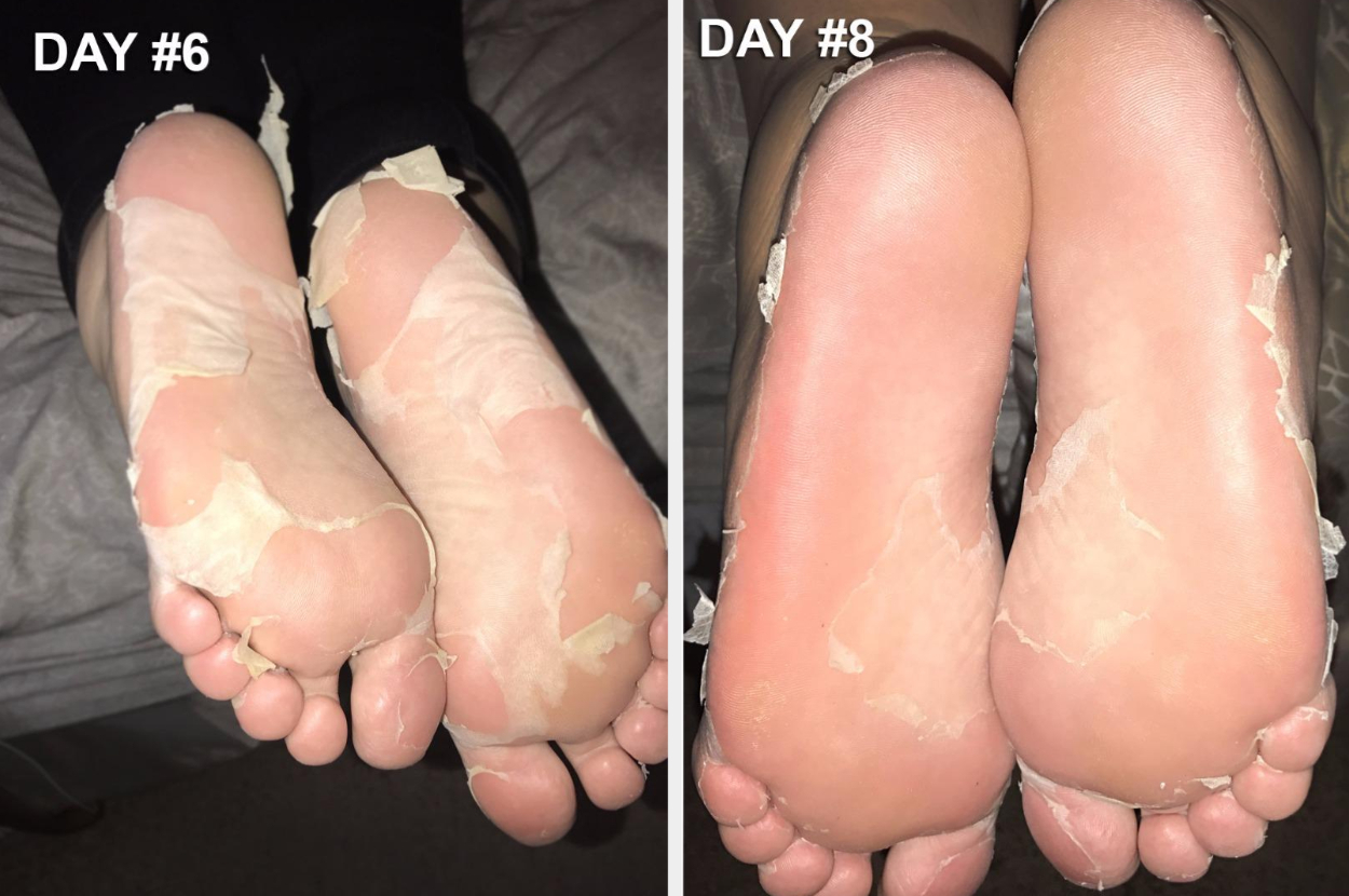 19 Things For Anyone Whose Feet Have Seen Better Days