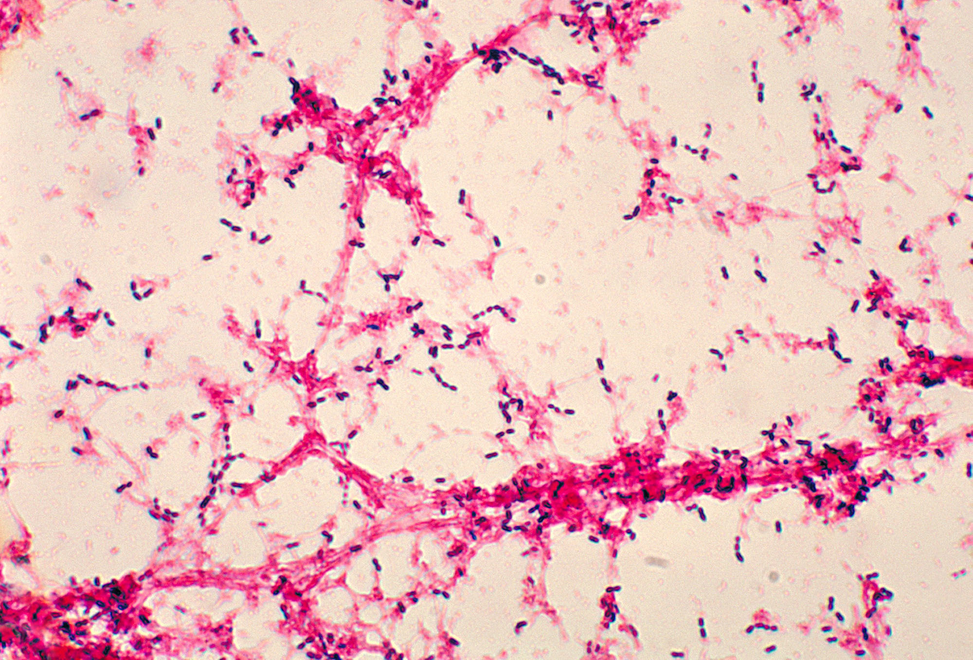 Палочка пневмонии. Стрептококк пневмонийный. Streptococcus pneumoniae (пневмококк). Streptococcus pneumoniae под микроскопом. Streptococcus pneumoniae. Пневмония.