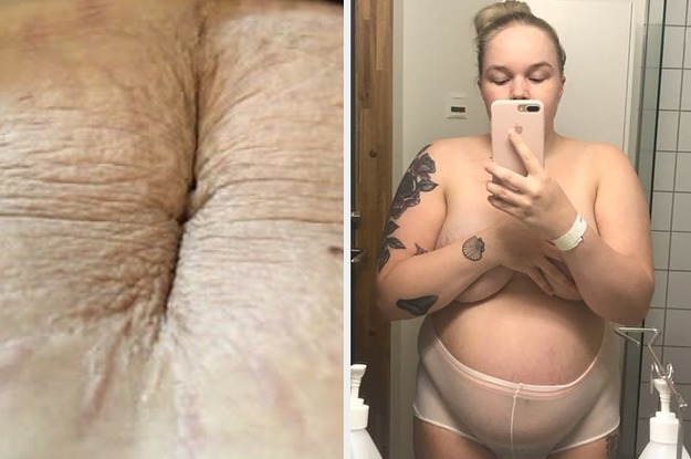 29 Moms Shared Photos Of Their Bodies Right After Giving Birth And It Perfectly Shows The Beauty Of Motherhood
