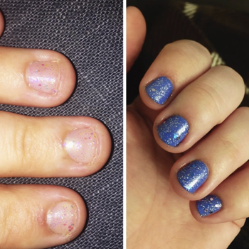 The left half shows a reviewer's nails bitten down to the flesh. The right half shows the same person's nails with blue polish. They're still short but longer than the first image.