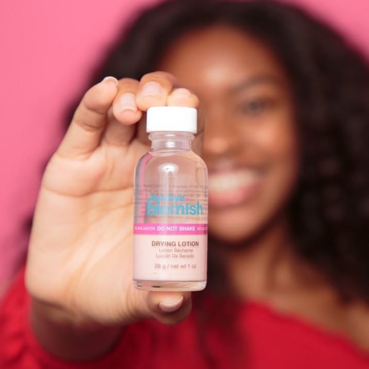 A person holding up a bottle of blemish drying lotion